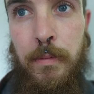 Nordik Piercing: Piercing medusa