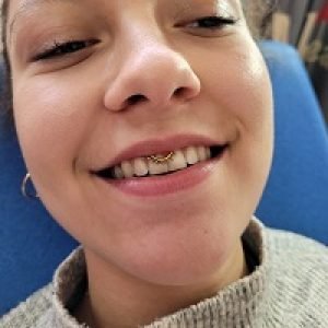 Nordik Piercing: Piercing Smiley